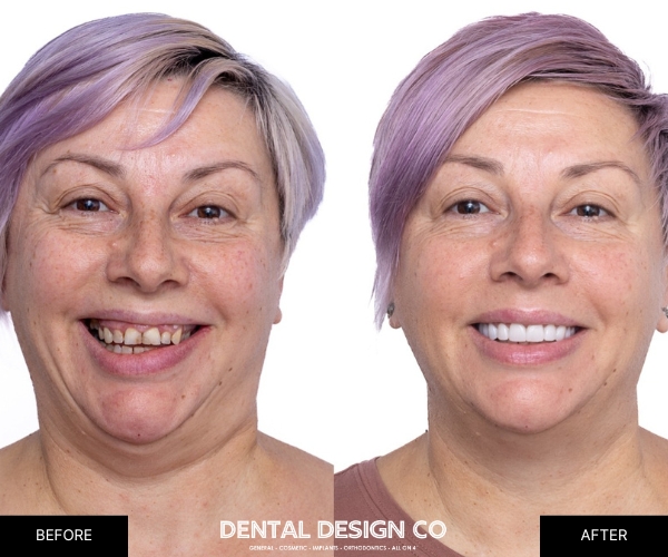 Inside Dental Design Co